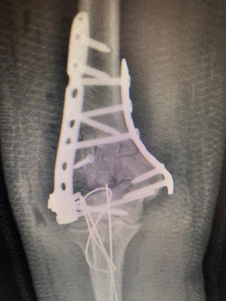 Javier Orlando Montero Gil-6