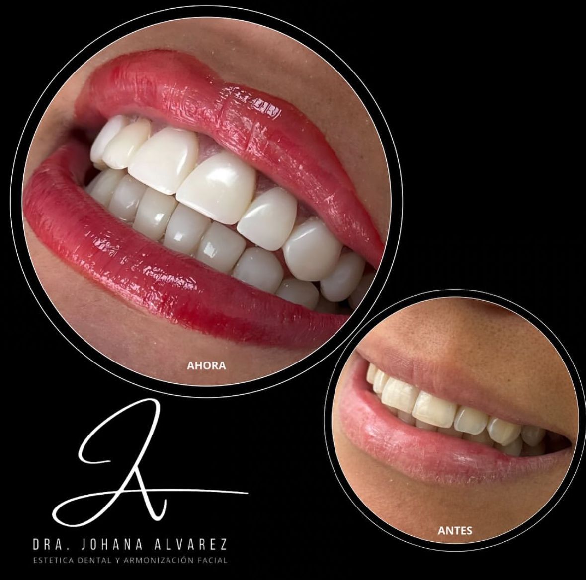 Johana Alvarez Castaño-5