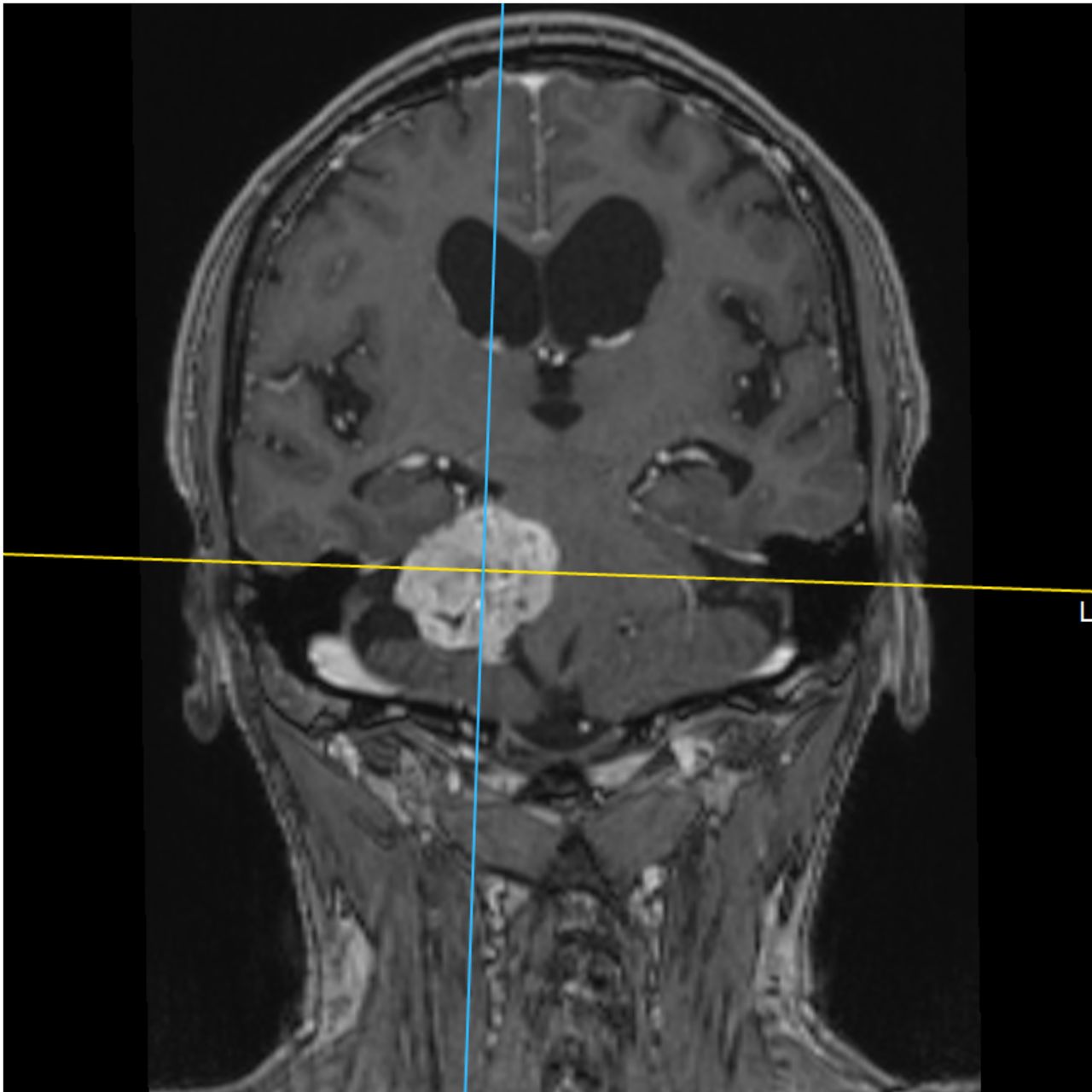 David Tafur Muñoz-1900