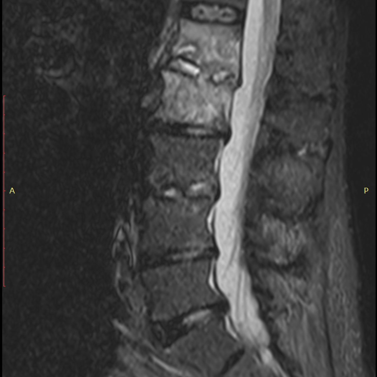 David Tafur Muñoz-1716