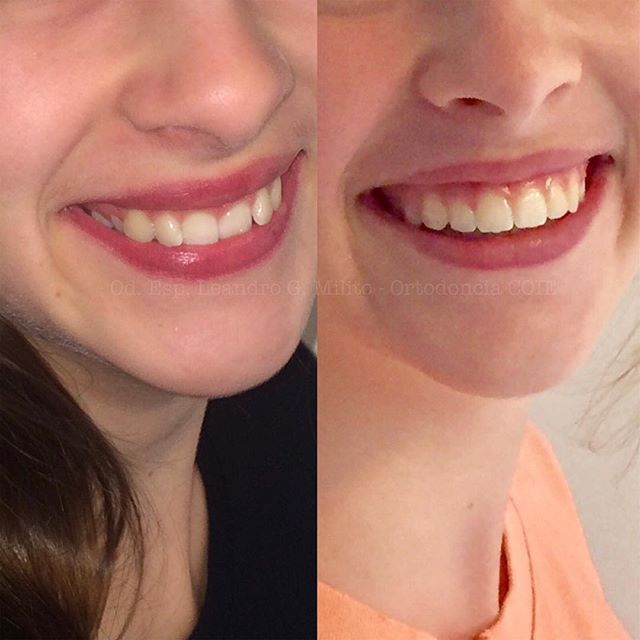 Leandro G. Milito-11