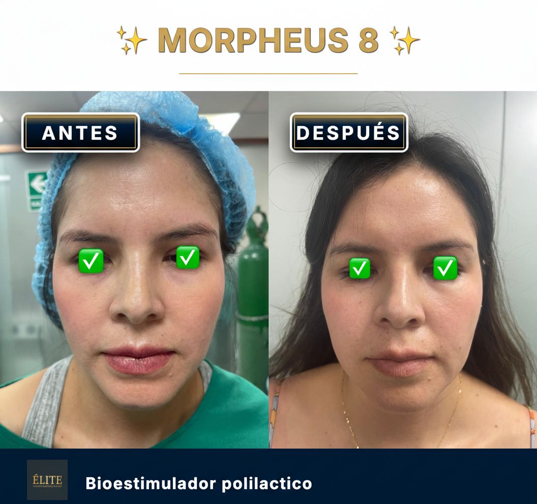 Roberto Alexander Rodriguez Zuñiga-5