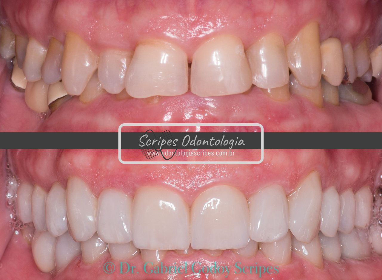 Gabriel Godoy Scripes-40