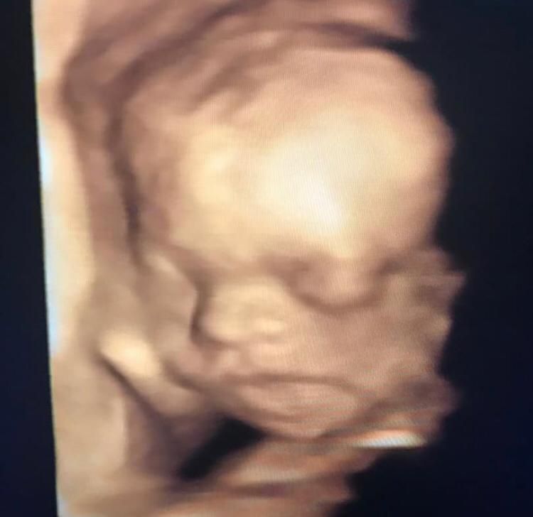 Fatima Akemi Tamaru-49