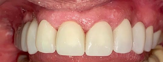 Juan Esteban Galvis Rodríguez-4