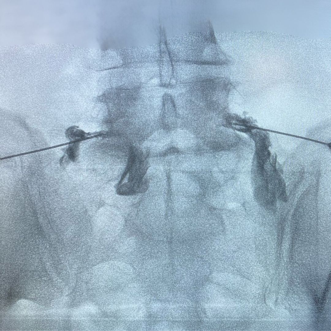 David Tafur Muñoz-2188