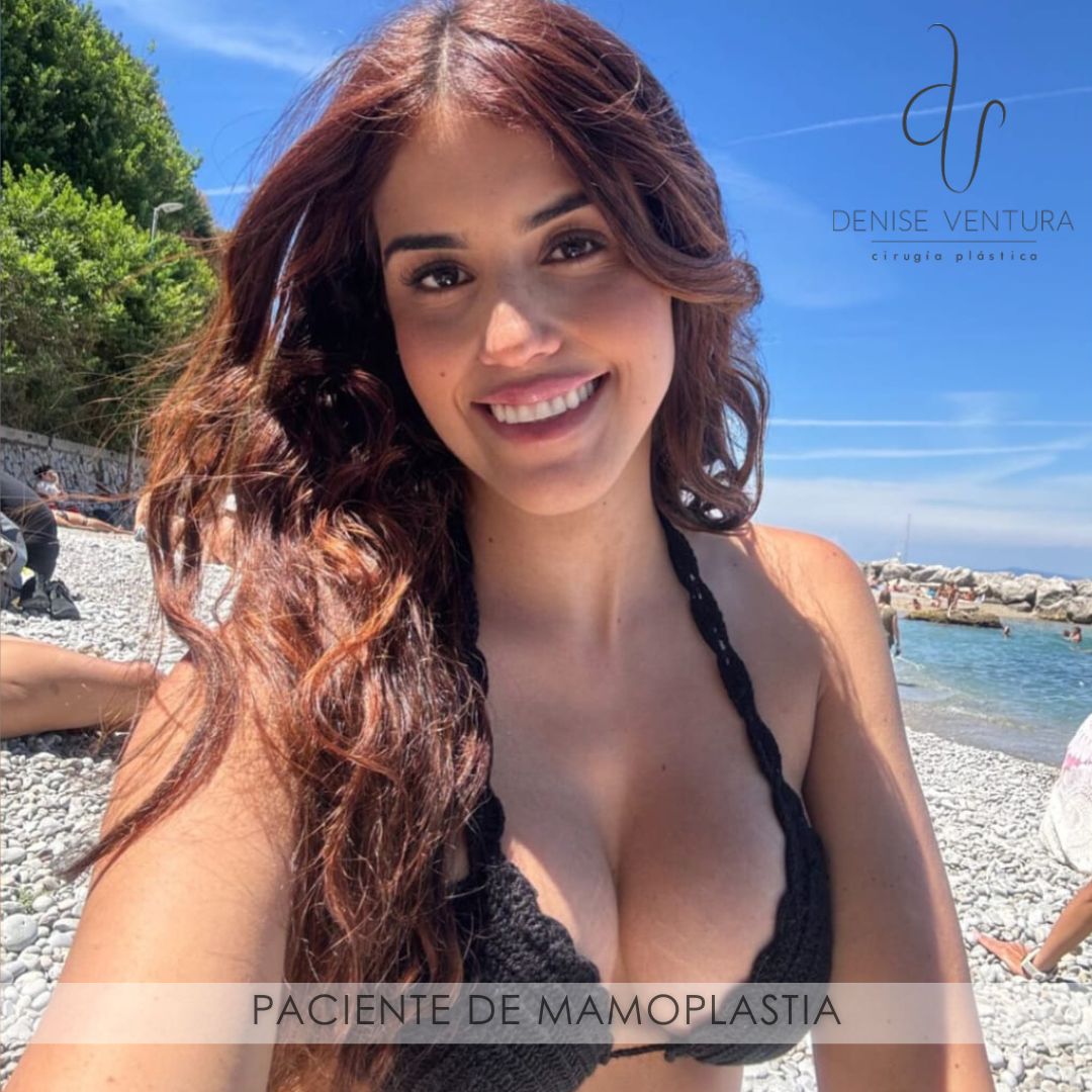 Denise Ventura Perez-7