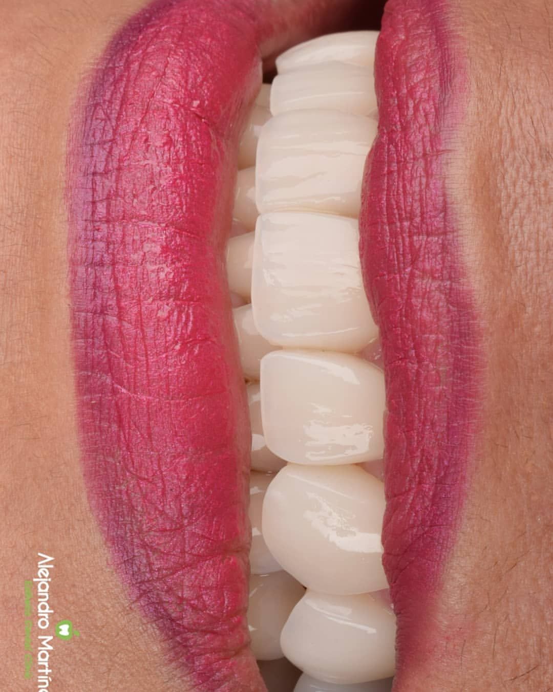 Alejandro Martinez-3