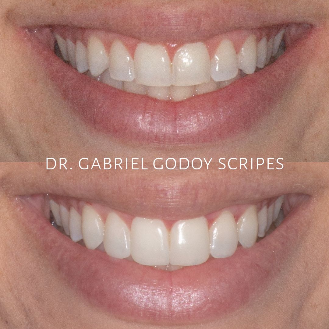 Gabriel Godoy Scripes-7