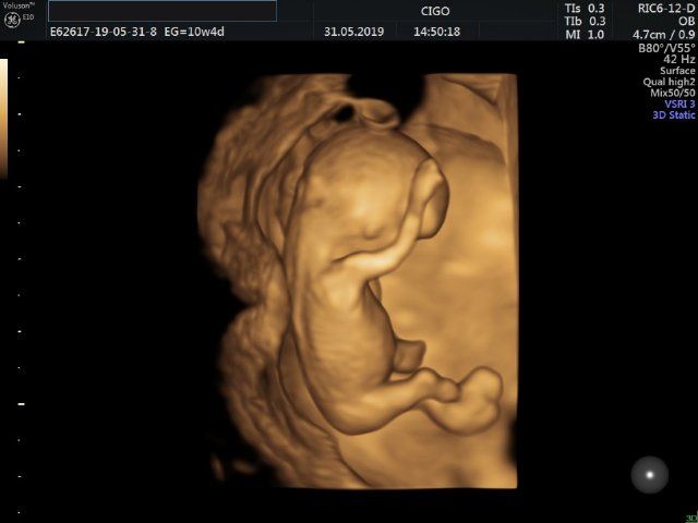 Raul Javier Banderas Pumarino-18