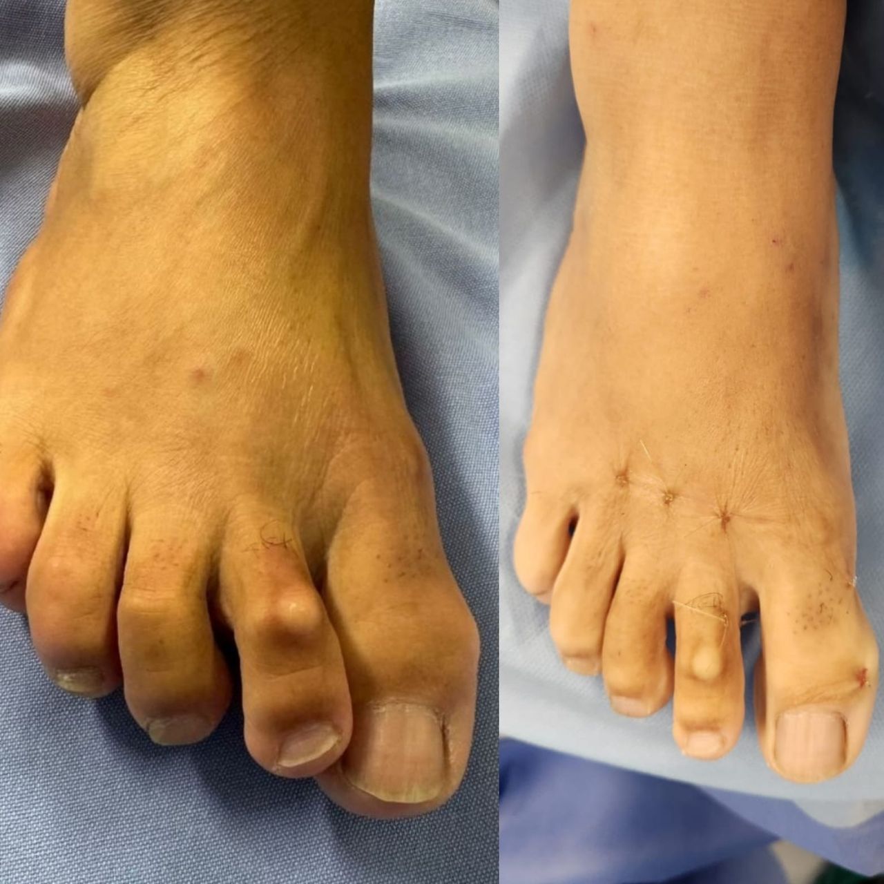 Leandro Jacomassi Machado-6