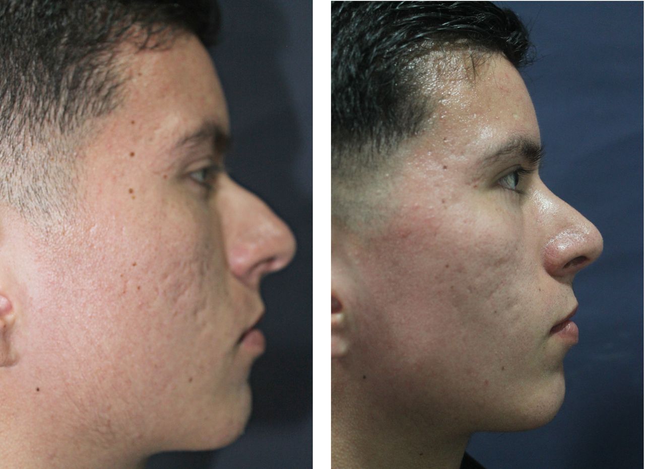 Jorge A Holguin Ruiz-3