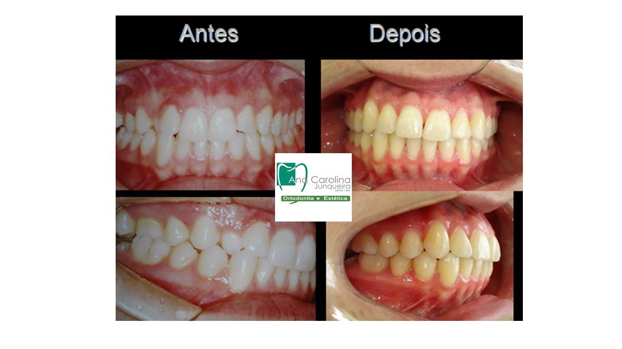 Ana Carolina Junqueira Defina-9