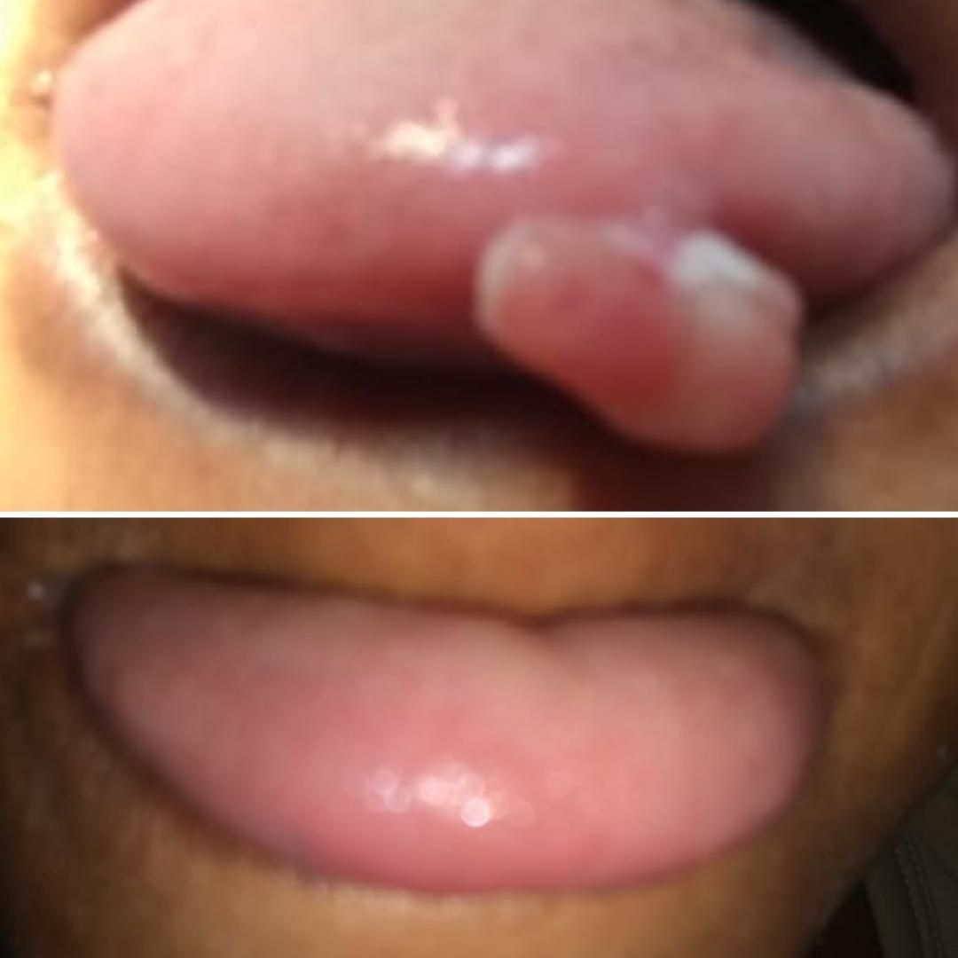 Alexandre Giannini-10