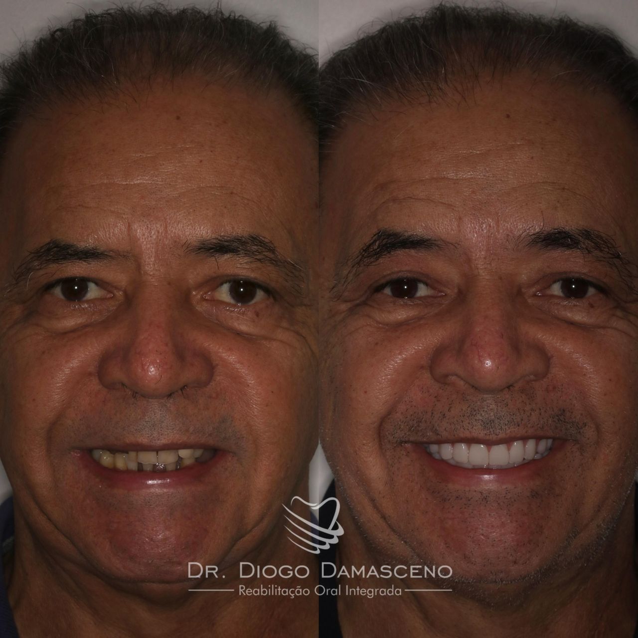 Diogo Damasceno-0