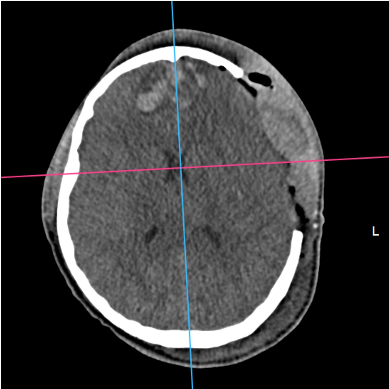 David Tafur Muñoz-1988