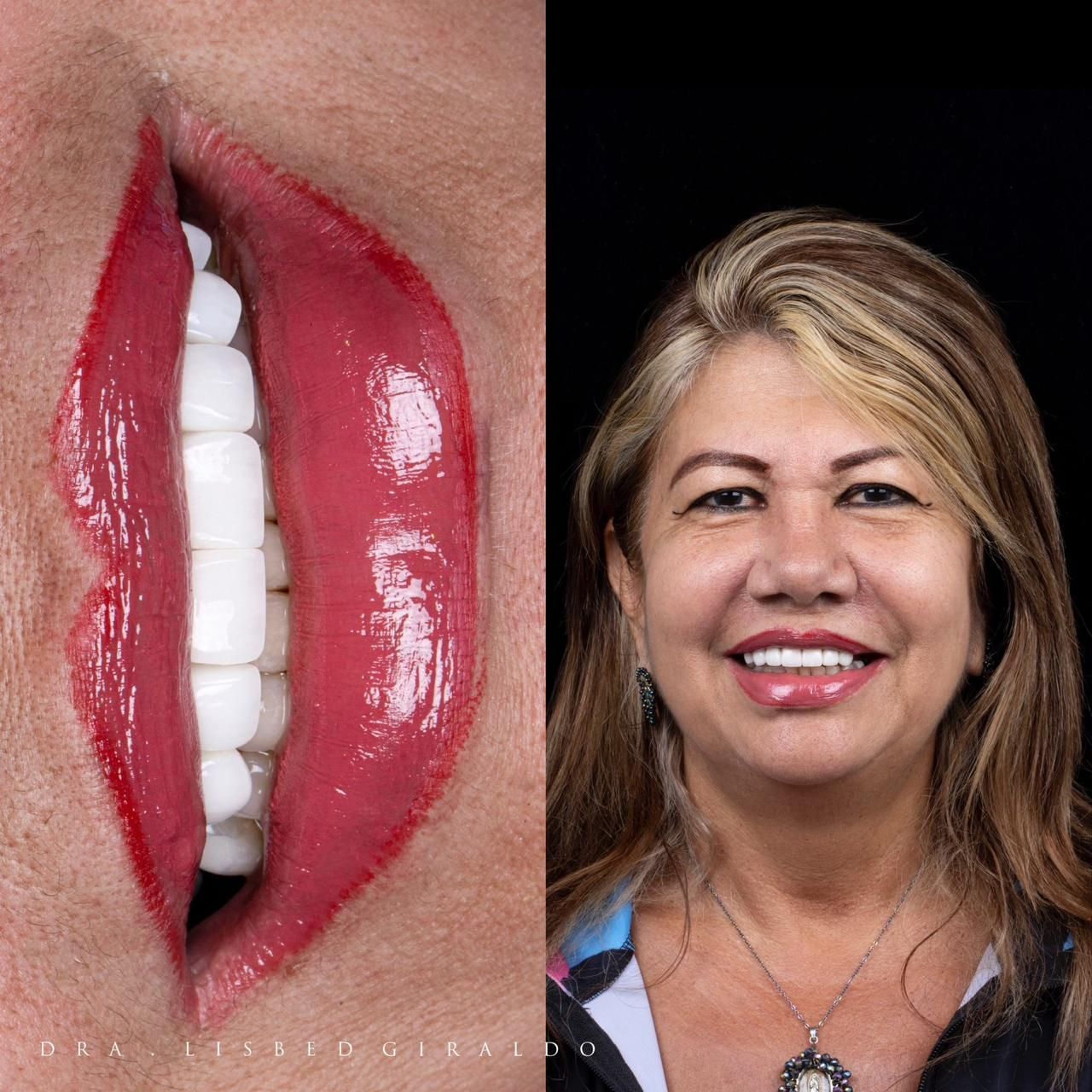 Lisbed Giraldo Olarte-37