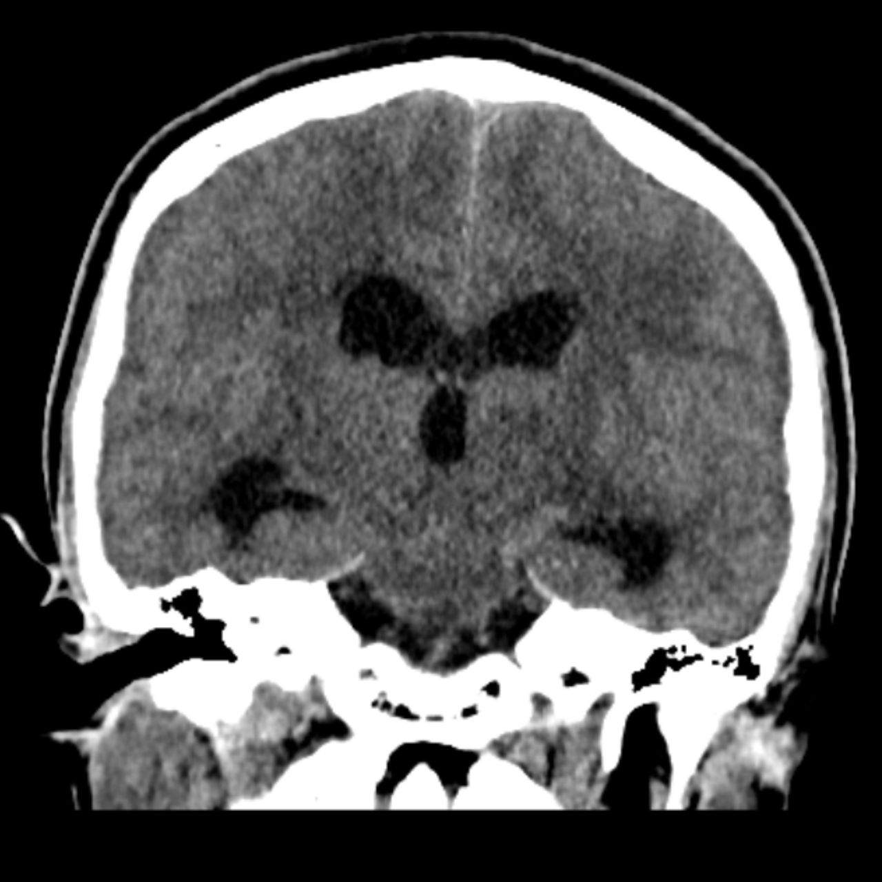 David Tafur Muñoz-1777