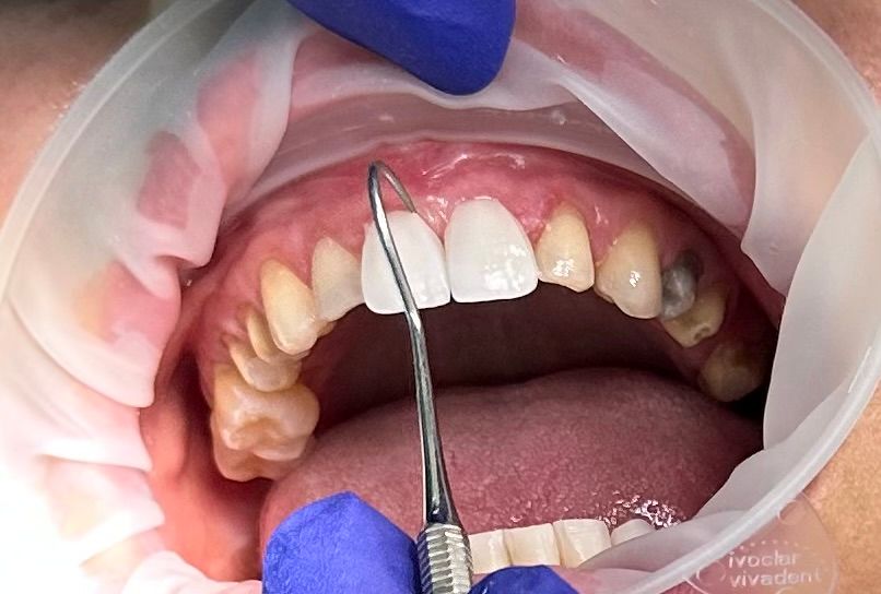 Fanny Valera Velásquez-76