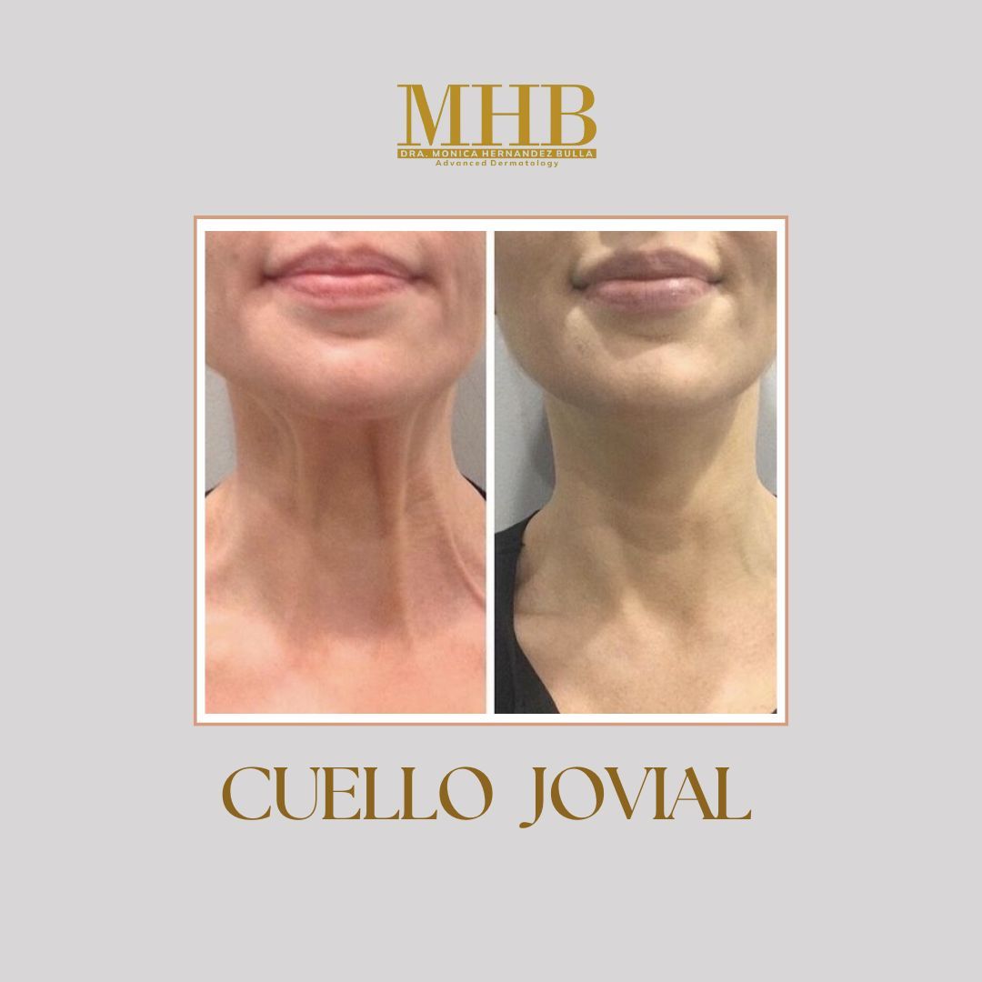 Mónica Hernandez Bulla-31