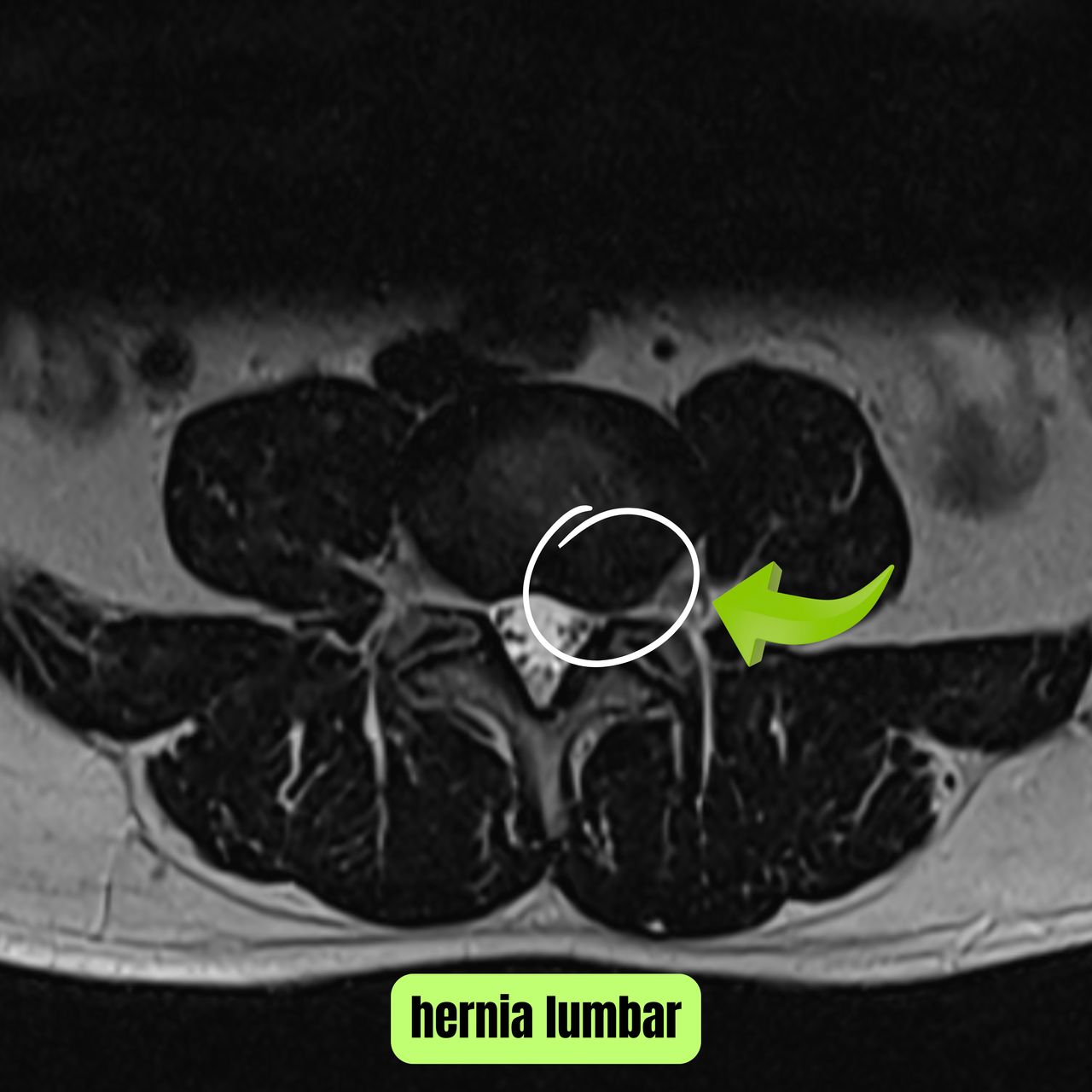 David Tafur Muñoz-1703