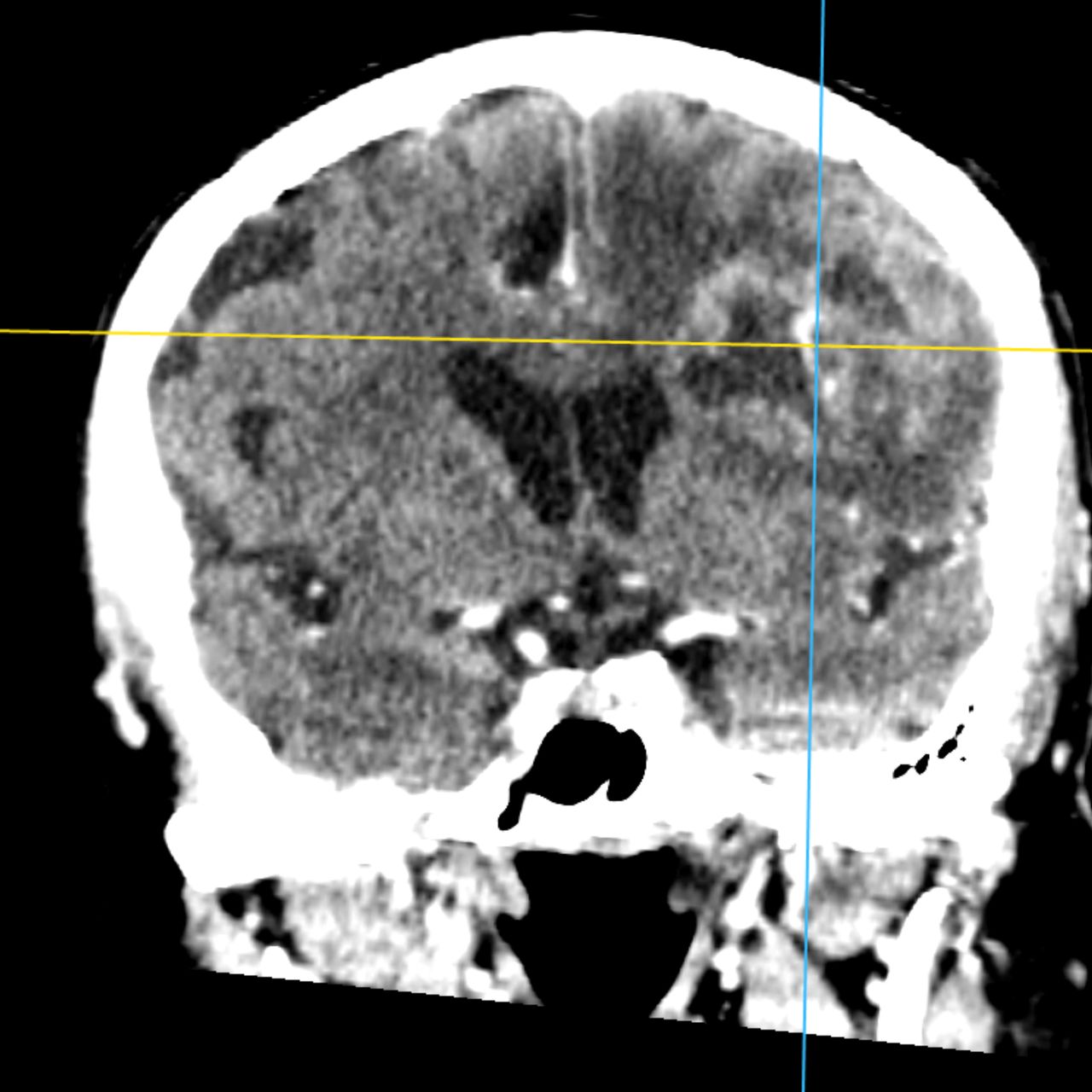 David Tafur Muñoz-1744