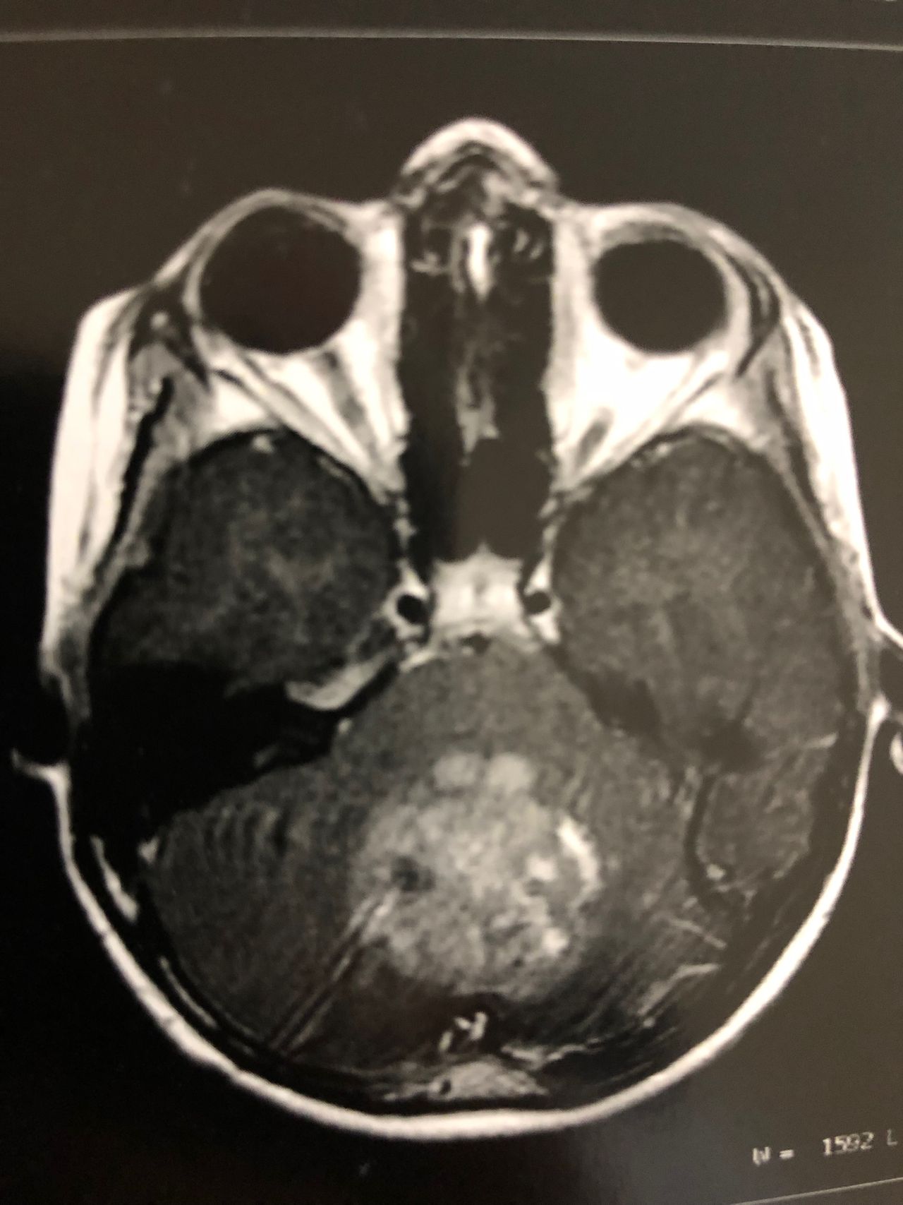 José Lopes Sousa Filho-33