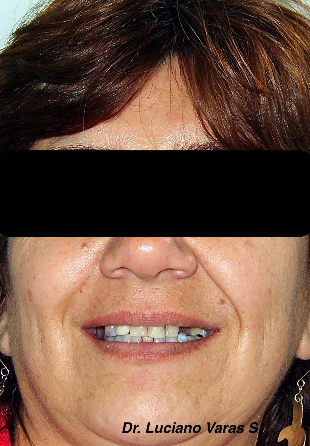 Luciano Varas Salinas-6