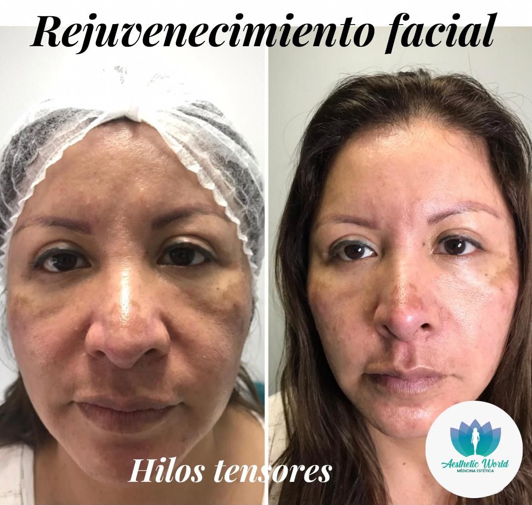 Jhonatan Oyola Farfán-15