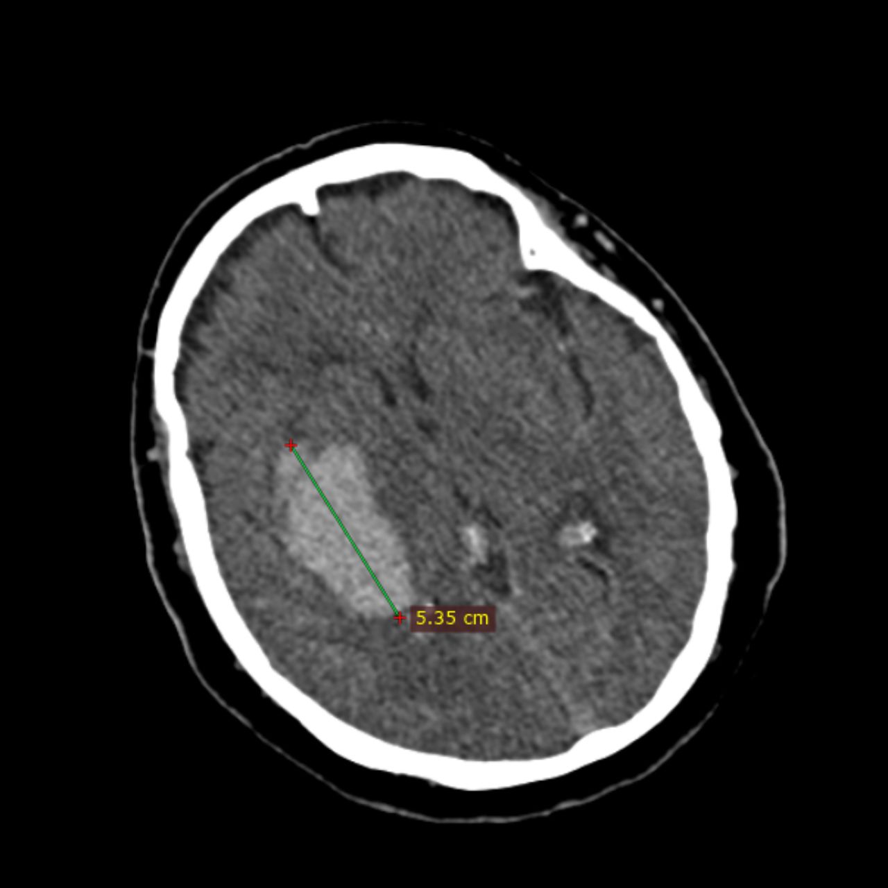 David Tafur Muñoz-2142