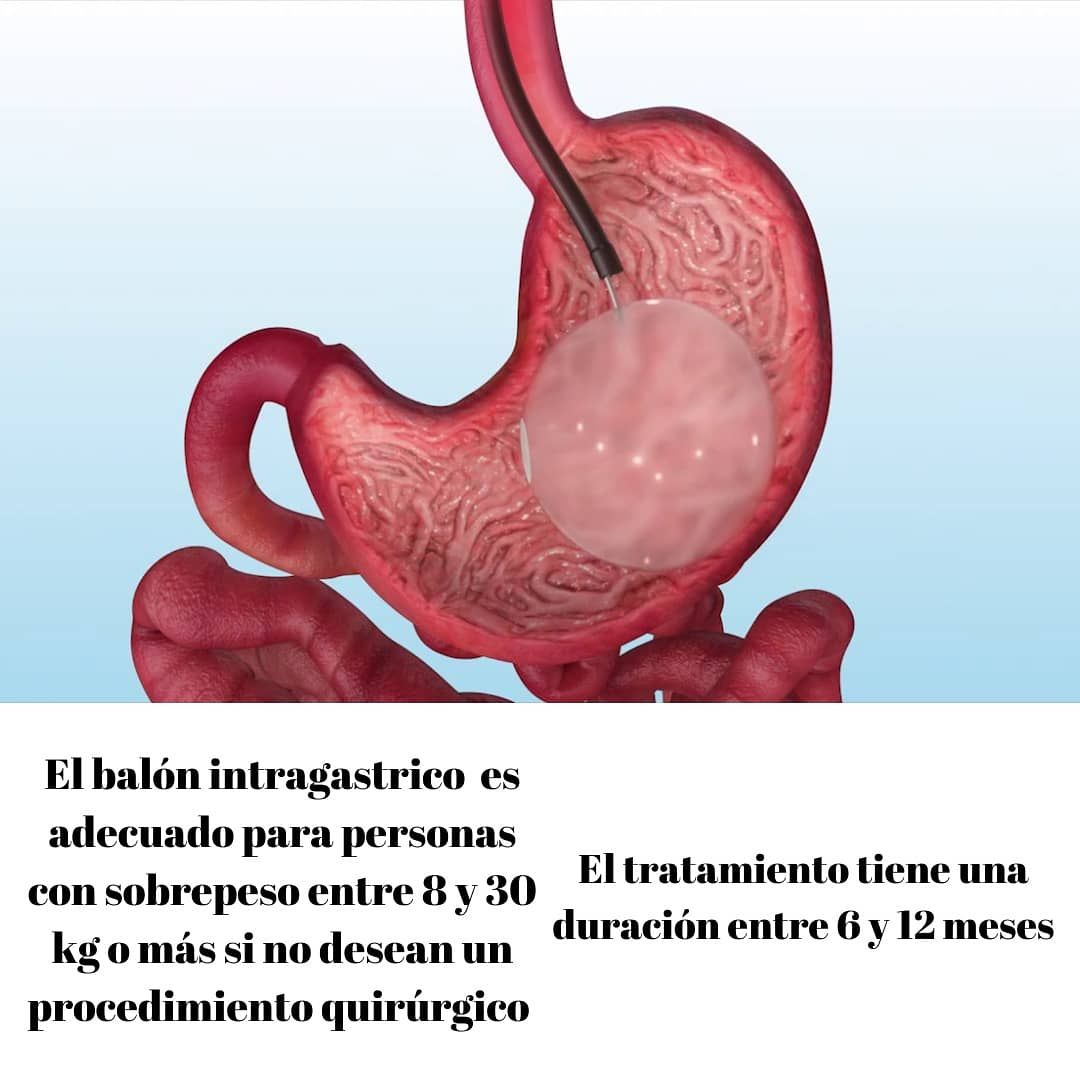 Luis Gerardo Villota Gonzalez-9