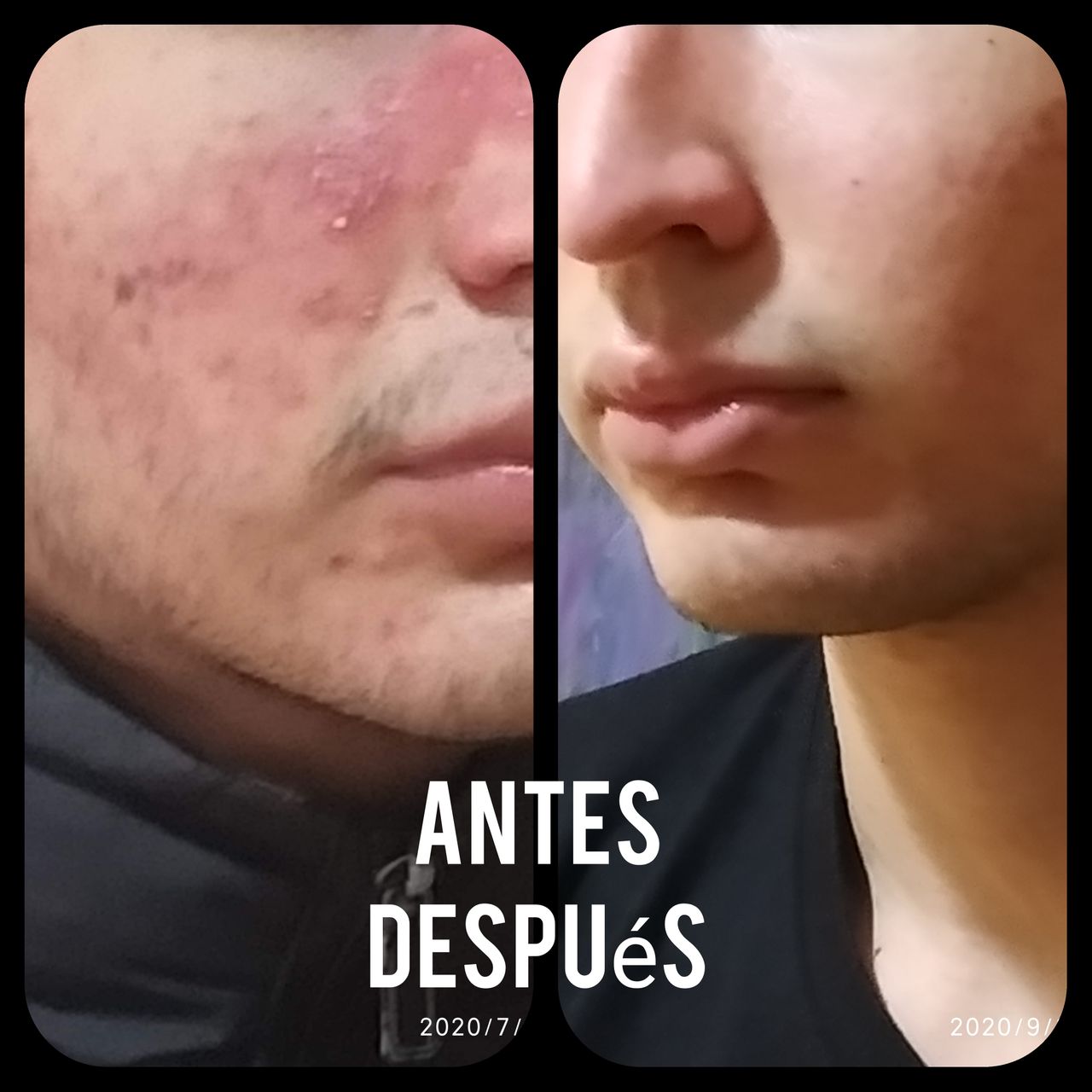 Alejandra Meijide-43