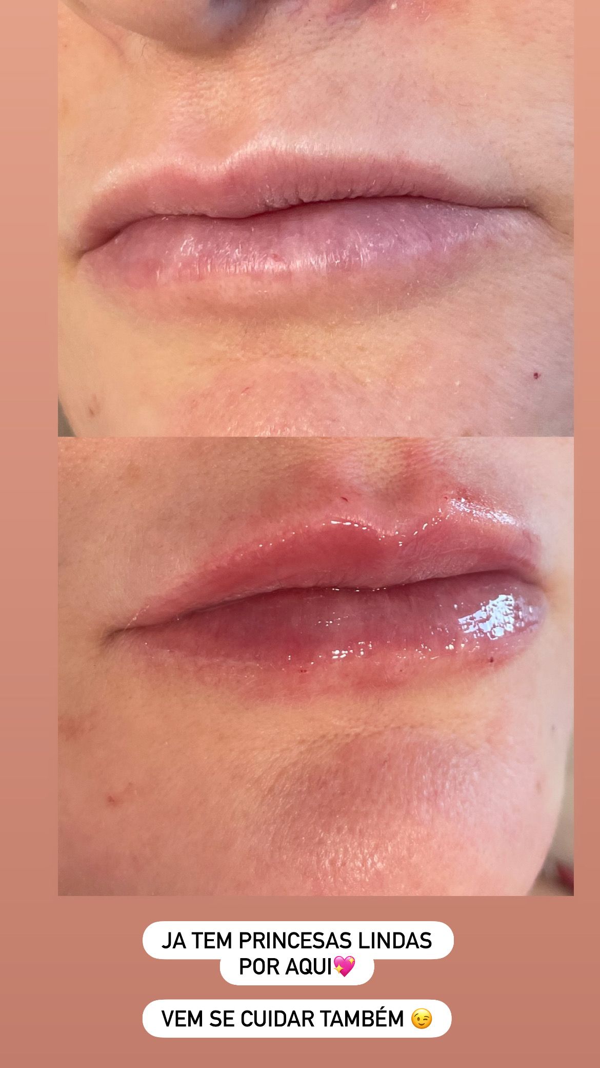 Dayse Hellen Teles Barroso-10