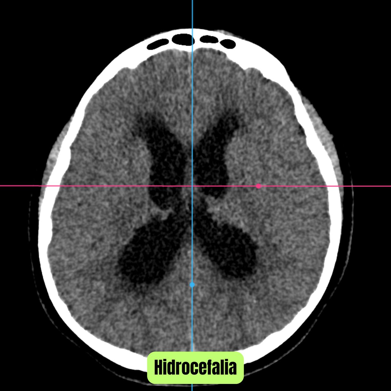 David Tafur Muñoz-1772