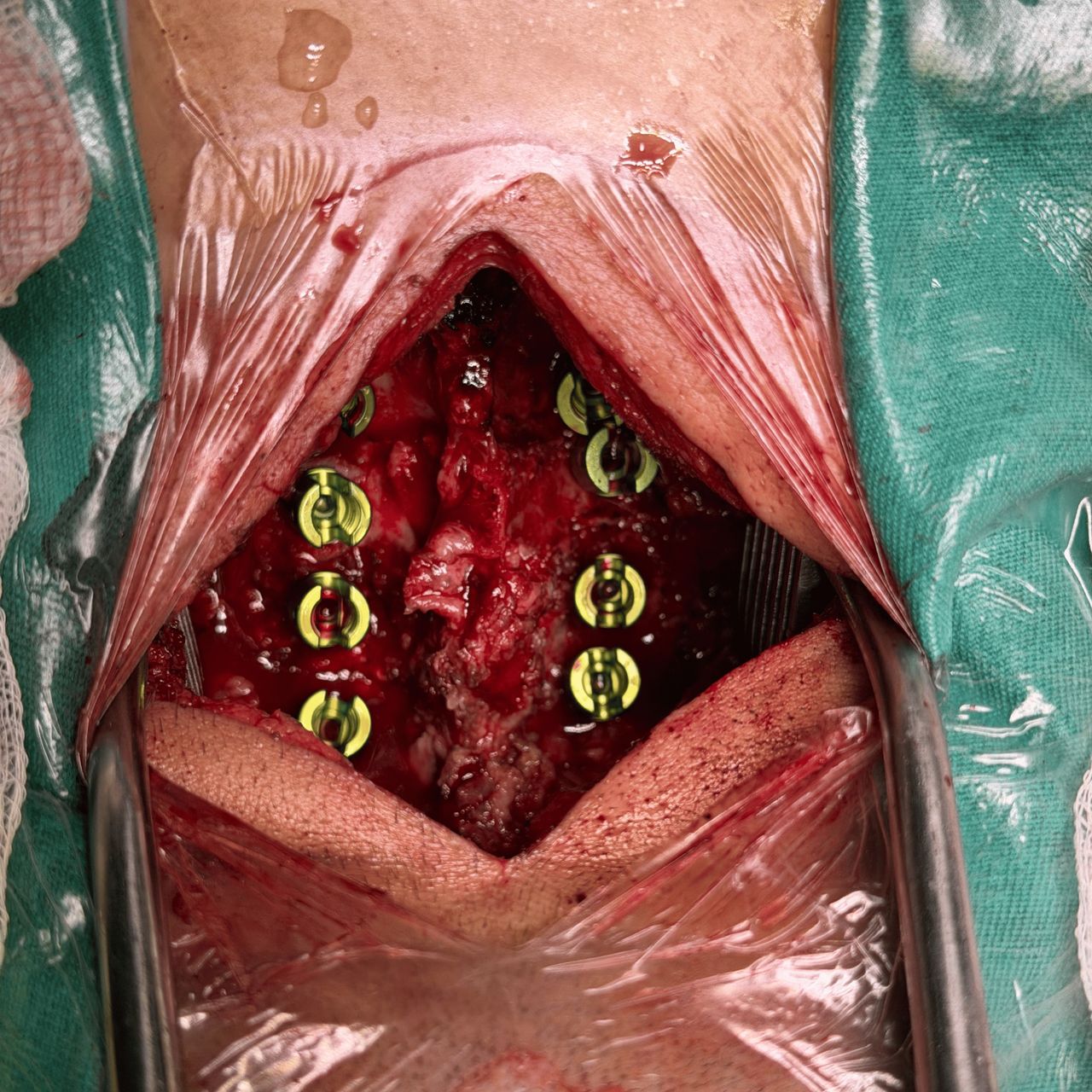 David Tafur Muñoz-2333