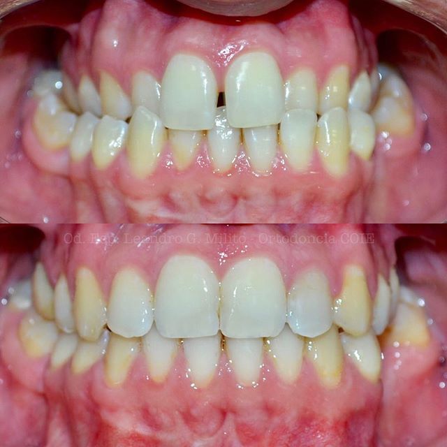 Leandro G. Milito-17