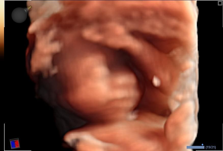 Benjamín Villarroel Castillo-16