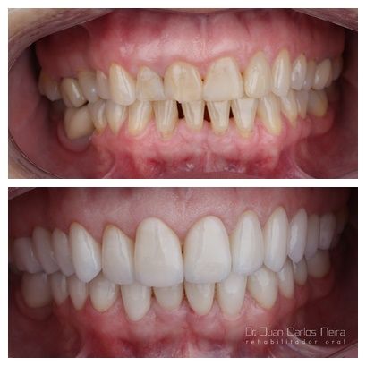 Juan Carlos Neira Rueda-11