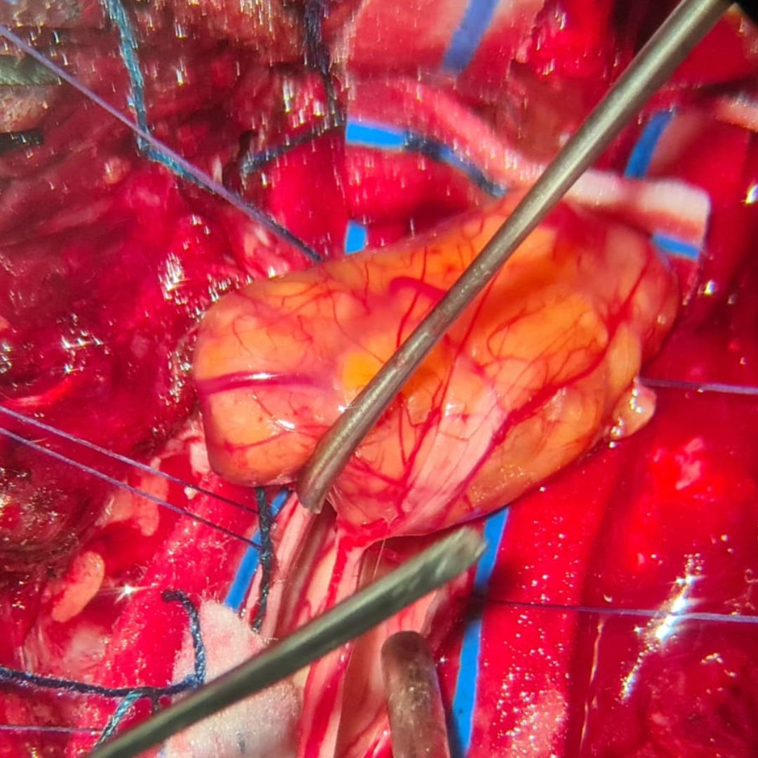 David Tafur Muñoz-2117