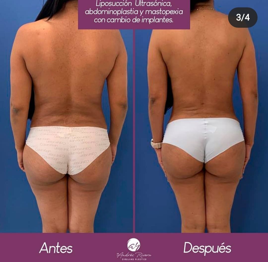 Andrés Rivera López-6