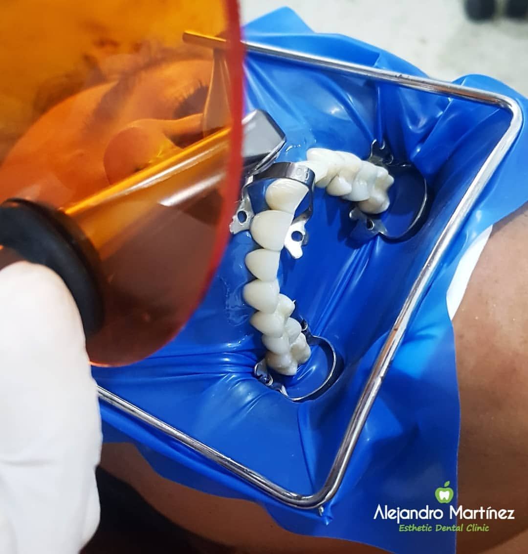 Alejandro Martinez-5