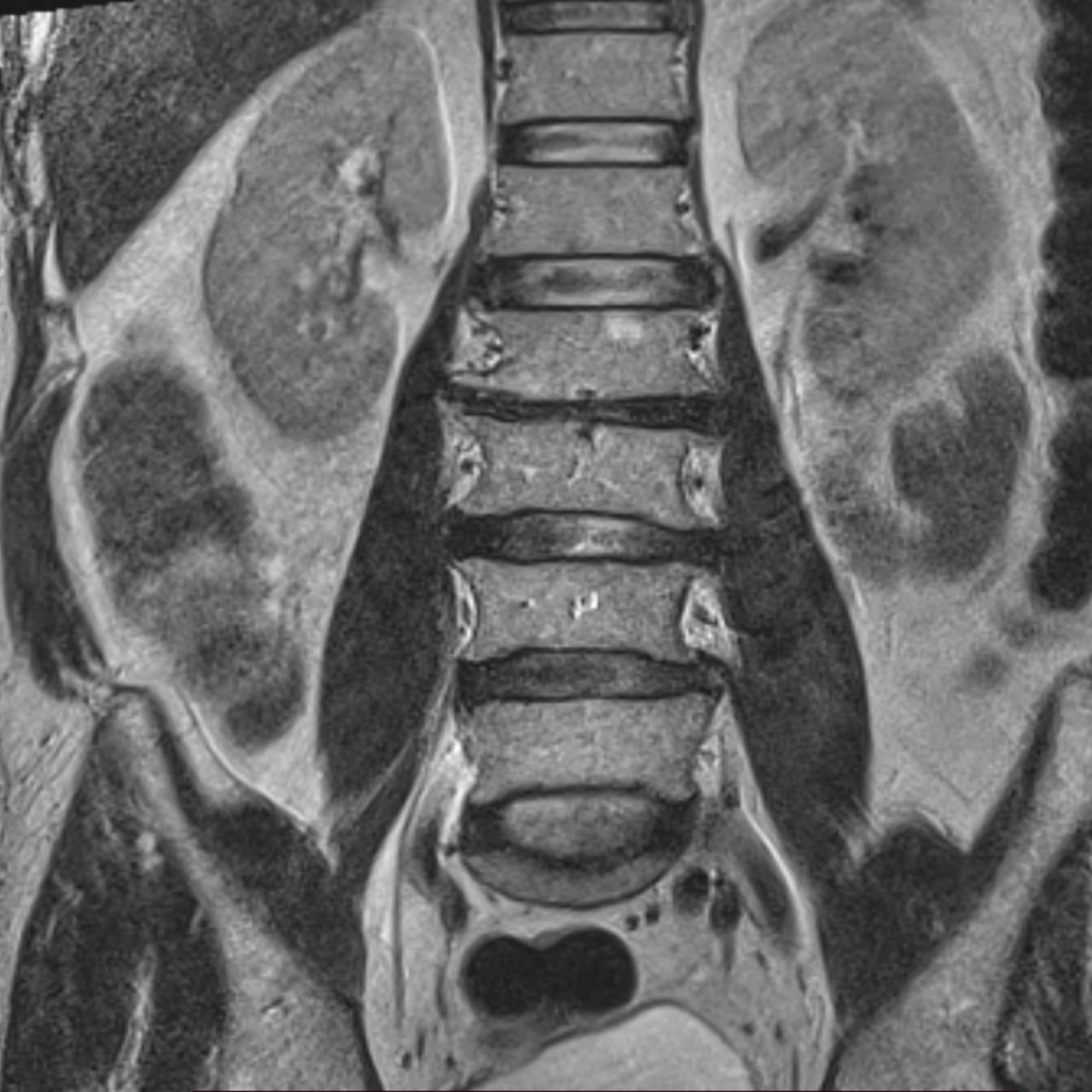 David Tafur Muñoz-1348