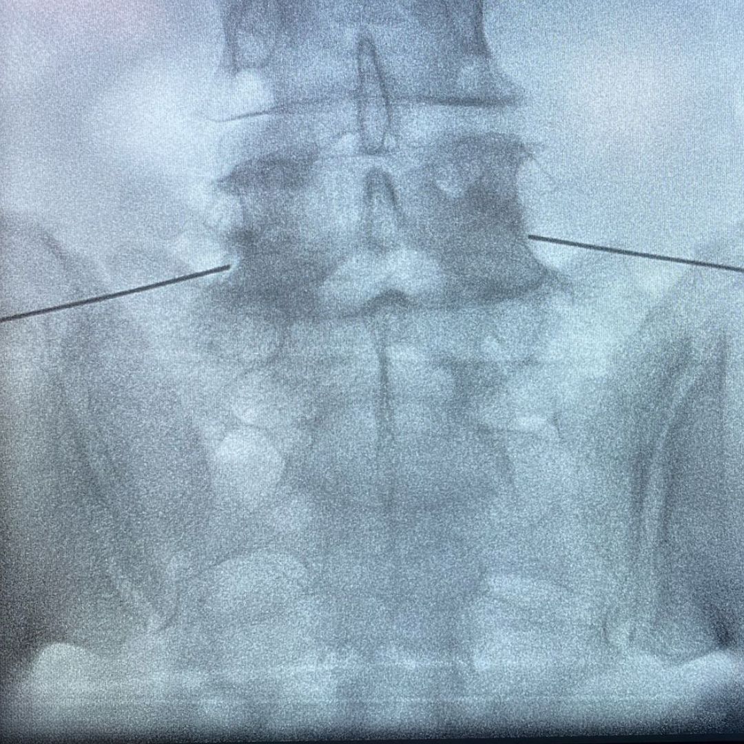 David Tafur Muñoz-2132