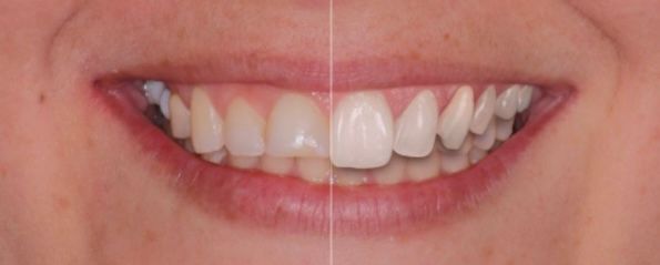 Luis Muñoz Tolhuysen-7