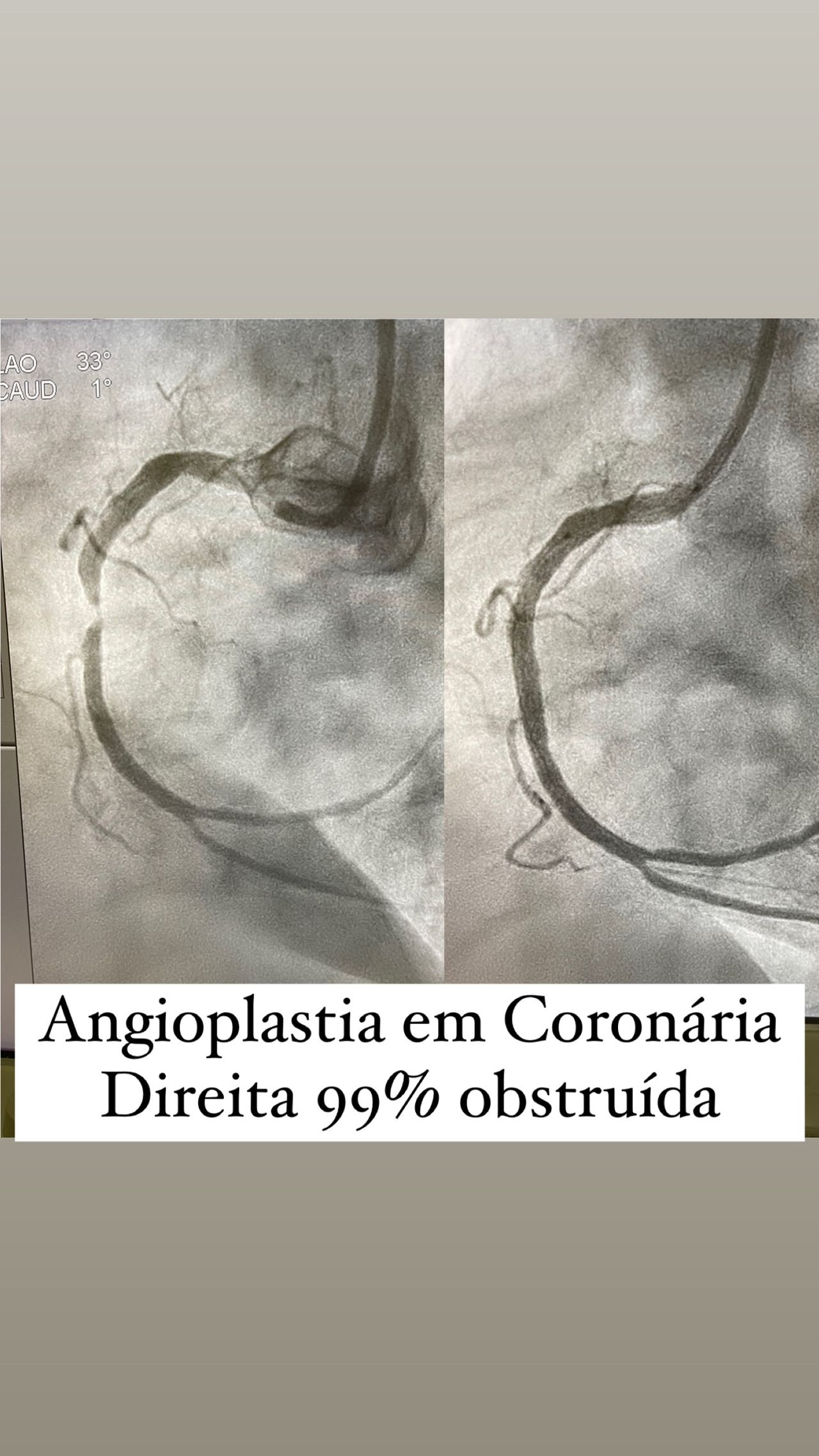 Diogo Antônio Gomes Tiago-3