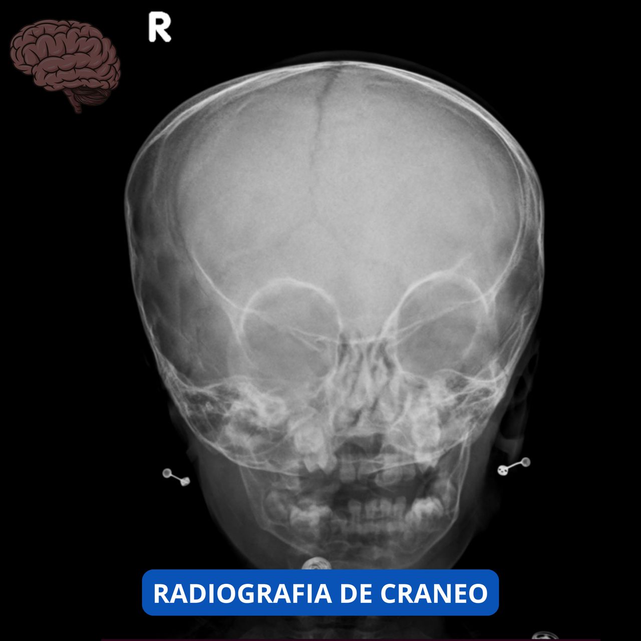 David Tafur Muñoz-1873