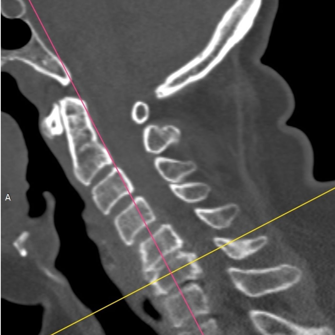 David Tafur Muñoz-1484