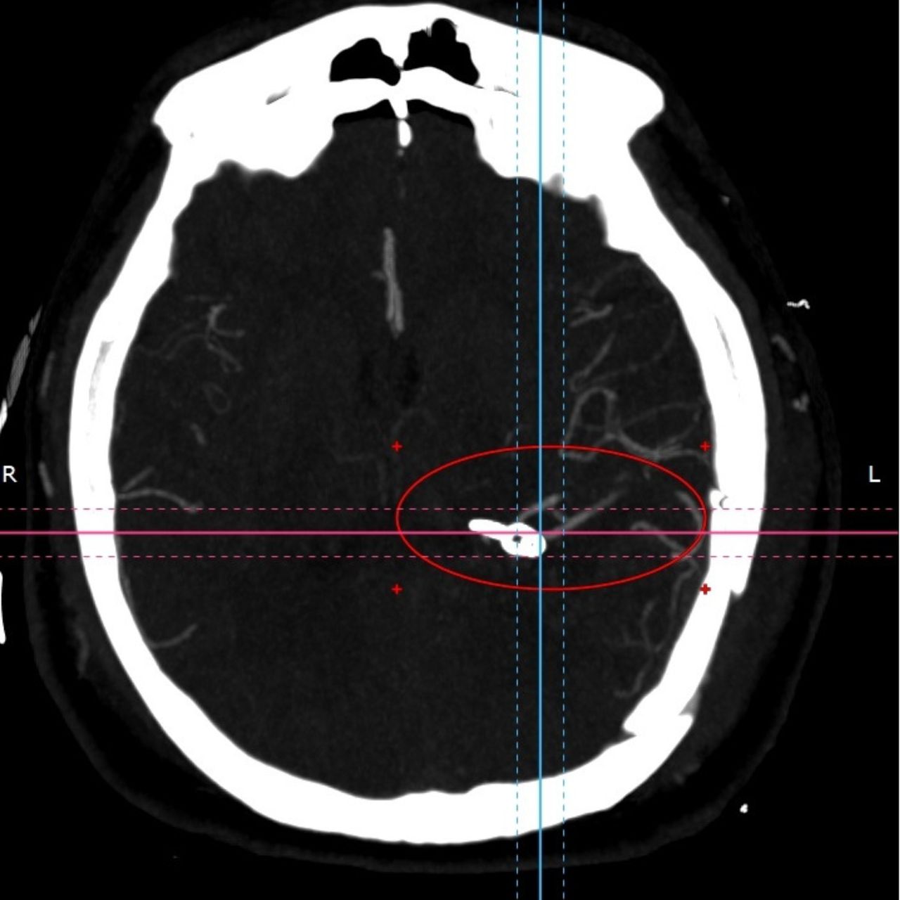 David Tafur Muñoz-1448