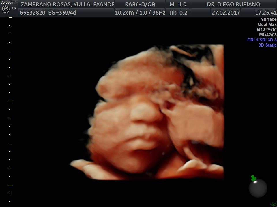 Diego Giovanni Rubiano Zarate-4