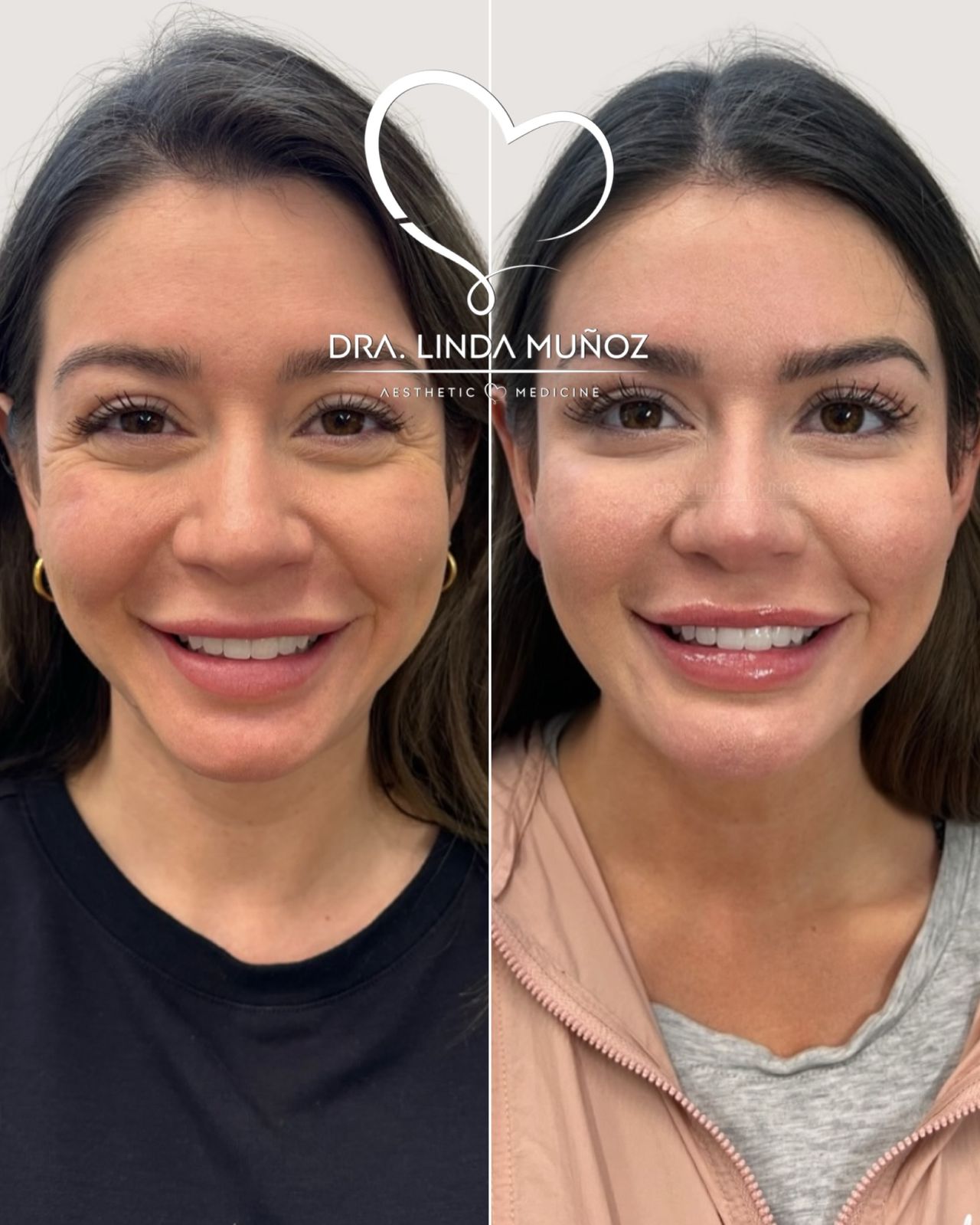 Linda Muñoz-35